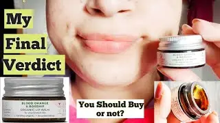 Juicy chemistry blood orange and rosehip lip balm review | After Finishing the tub | Bhawna Sharma