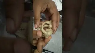 Anatomy of Atypical cervical vertebra in bangla...