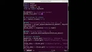 Analyze DICOM Medical Images Using Python & AWS S3 | AI in Healthcare