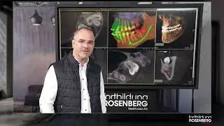 Trailer &laquo;Instrumentenflug in der Implantologie und Chirurgie&raquo; &ndash; Dr. Oliver A. Centrella