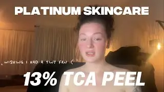 13% TCA PEEL ON ROSACEA | IF I CAN DO IT SO CAN YOU ! 