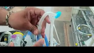 MAX -Aura Demo video -  Bubble Cpap for Neonate/ Pediatric Patients