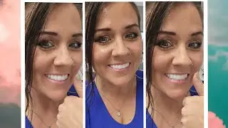 GETTING MY PERMANENT ZIRCONIA ALL ON 4 TEETH! (vlog style) July 10th, 2024. Part 2 😃