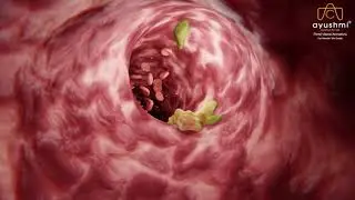 3D Animation | Medical Animation | Animation | 3D Animation Studio in India
