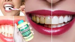 Dentonic Tooth Powder Benefits| Teeth whitening at home