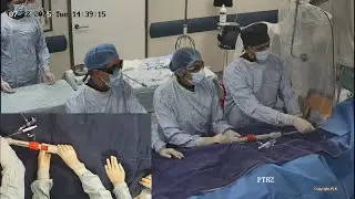 Minimalist approach to tricuspid valve therapy - PCR Rio Valves 2025