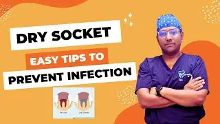 Dr Rudra Mohan | Understanding Dry Socket: Causes, Symptoms, and Prevention| Extraction Socket Pain