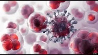 Documentary HIV/AIDS Channel - The Other Side of AIDS, HIV and AIDS