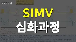 SIMV(Synchronized Intermittent Mandatory Ventilation) 모드 상세 설명