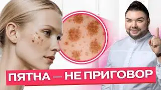 Солнечное лентиго (старческие пятна): как распознать, осветлить и не навредить коже