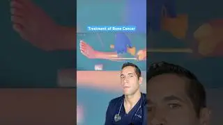 Doctor Reacts: bone cancer treatment