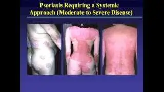 Dermatology