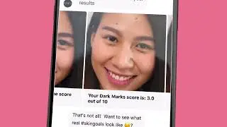 Whitecoat x Pond's Skin Advisor