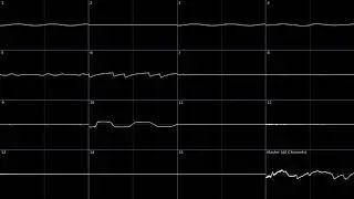 Atomica Deluxe (PopCap Games, 2002) Soundtrack (Oscilloscope View) (NO LOOP)
