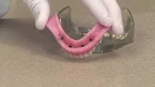 Denture Stabilisation