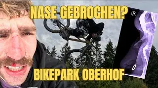HAB ICH MIR DIE NASE GEBROCHEN ? / BIKEPARK OBERHOF MIT SCHELLE / OSCARWILLBMX