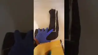 HUGE LONG ARM CAST 😬