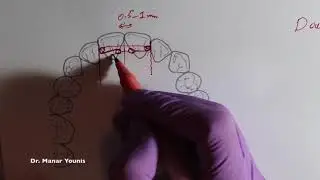 Двойная Z-пружина