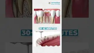 Single-Sitting Root Canal? Here's How Advanced Tech Makes It Possible | Dr. Prashant Chaudhry