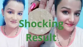 I Apply Ice Face Pack & Look What Happened/Got Instant Tighten,Brighten & Glowing Skin / 100% Result