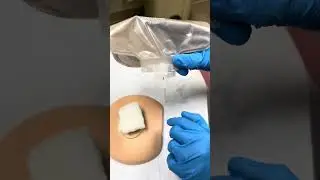 Ostomy Pouch Change with Eakin