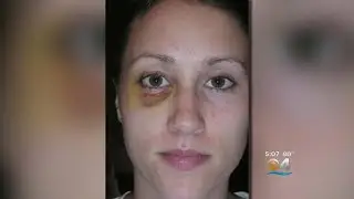 Trump On Rob Porter: 'We Wish Him Well. He Did A Good Job'
