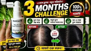 Wishcare Hair Growth Serum Review/ in Bengali/ 3 Months Experience/ চুল পড়া বন্ধ করার উপায় 