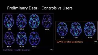 Kaan Salcin &mdash; HBHL Research Day 2020 Flash Talk