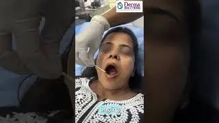 Lip Lightening at Derma Solutions Clinic, Bangalore. Gentle, Painless Peel for Softer Lips.