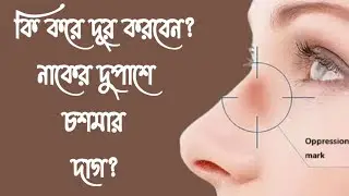 How To Get Rid Of SPECTACLE MARKS On Nose | How To Remove SPECTACLE MARKS From Nose