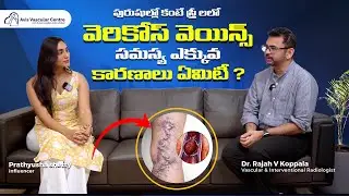 Why Varicose Veins Affect Women More Than Men | Dr. Rajah V. Koppala