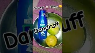 how to use lemon juice and coconut oil for dandruff😱 #shorts