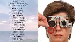 Autofocus PRO IOL detailed informative and self explanatory