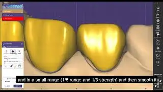 VITA DENTAL LAB Design Zirconia