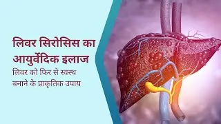 लिवर सिरोसिस का आयुर्वेदिक इलाज | Liver Cirrhosis Reversal Naturally | Ayurvedic Liver Treatment