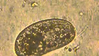 Pleuronema sp. (Fam. Pleuronematidae)