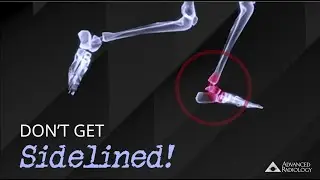 Common Orthopedic Conditions | Advanced Radiology