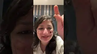 Acne & black spots  remedy |￼ glowing face mask for sensitive skin#Shorts#acne#skincare#glowup #fyp