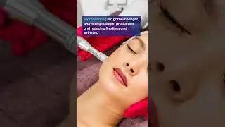 Microneedling in Allen, TX - How to Enhance Your Natural Beauty