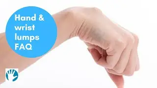 Hand and wrist lumps FAQ - Midland Hand Clinic