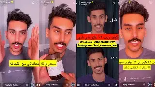 سنابات كويلي ومعاناته مع النحافه | تجربه كويلي لعسل التسمين | زاد ١٠ كيلو😳