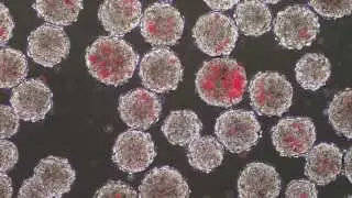 Tipos de Células Madre