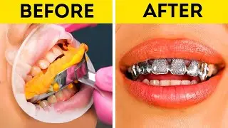 Make Your Own Stylish Grillz Without Breaking the Bank! 💰💎