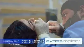 EVOSS İMPLANTI