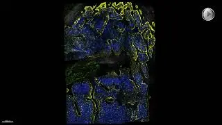 3D View of Mouse Bone Marrow