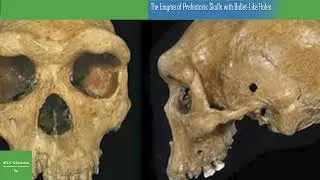 The Enigma of Prehistoric Skulls with Bullet Like Holes