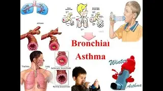 we have the best doctor to treat asthma,COPD, cough, pneumonia,TB, lung cancer #asthma #copd #shorts