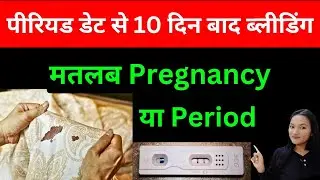Period date se 10 din baad Bleeding ho rahi hai to kiya ye Implantation Bleeding hai?