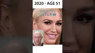 Gwen Stefani's NEW FACE