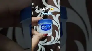 Magic of Vaseline 😱#ytshortsindia #shortsfeed #skincare #trendingshorts #yt #viral  #ytshorts
